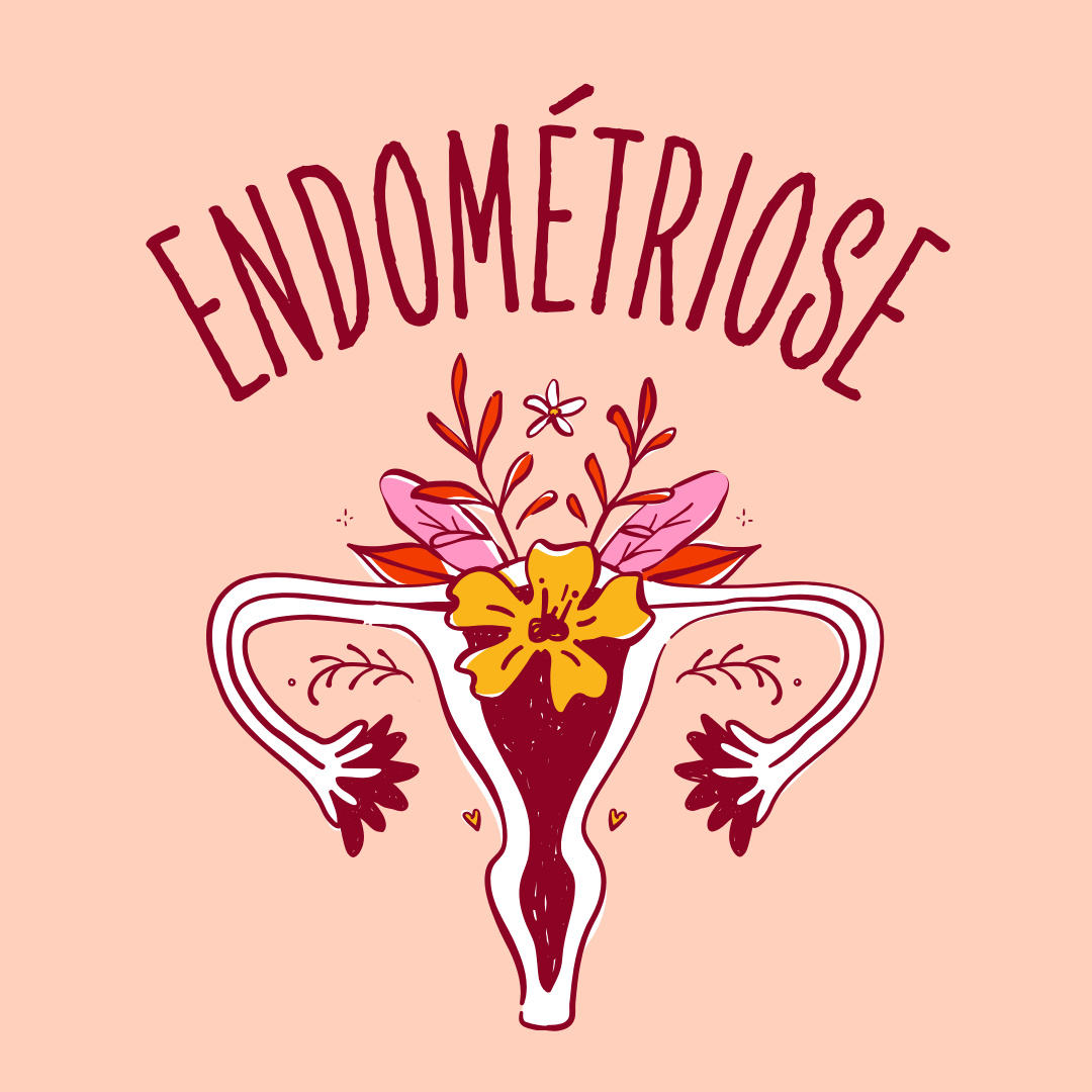 Image du parcours de soins Parcours endométriose